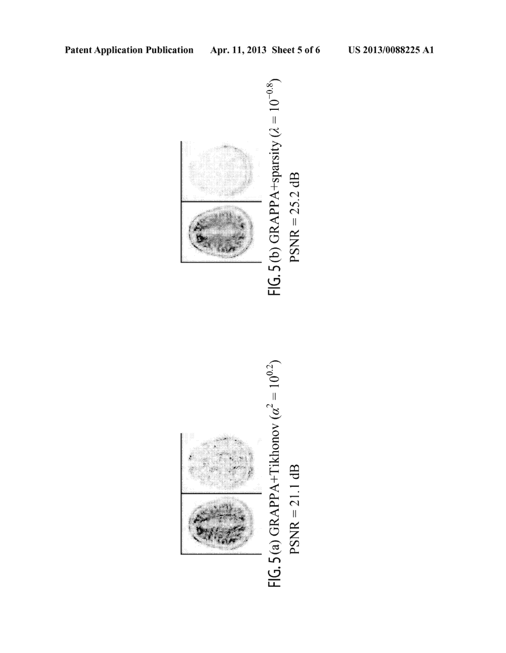 System for Reconstructing MRI Images Acquired in Parallel - diagram, schematic, and image 06