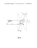 LASER SCANNING APPARATUS AND METHOD OF USE diagram and image