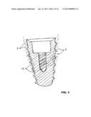 CONDENSING SKELETAL IMPLANT THAT FACILITATE INSERTIONS diagram and image