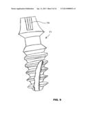 CONDENSING SKELETAL IMPLANT THAT FACILITATE INSERTIONS diagram and image