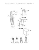 CONDENSING SKELETAL IMPLANT THAT FACILITATE INSERTIONS diagram and image