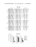 Biological Markers of Chronic Wound Tissue and Methods of Using for     Criteria in Surgical Debridement diagram and image