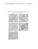 ANTIBODIES TO TUMOR ASSOCIATED PROTEINS diagram and image