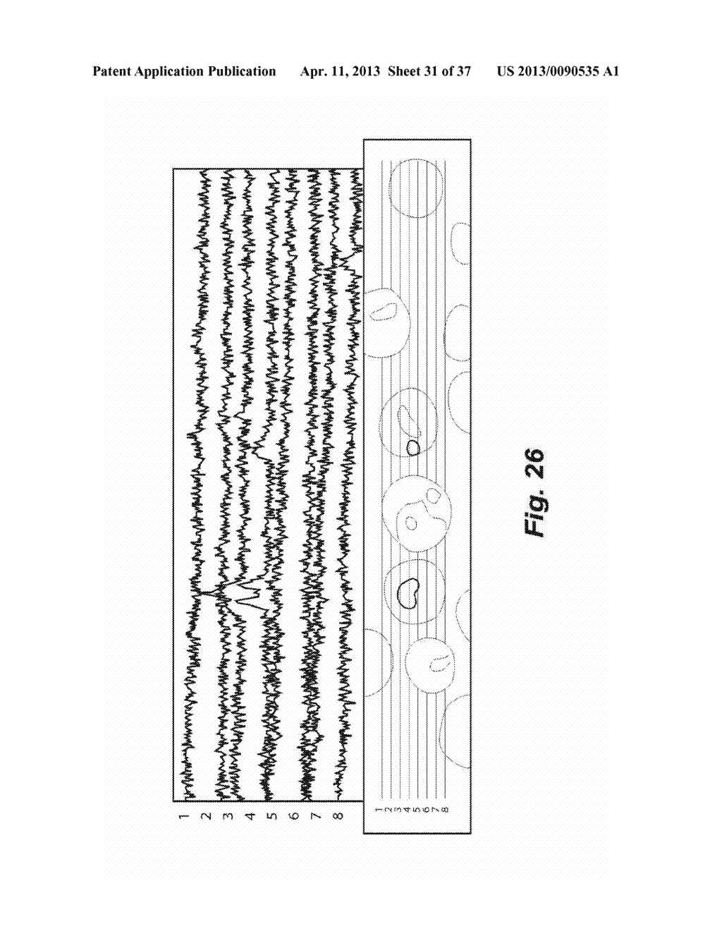 SYSTEMS, DEVICES, AND METHODS INCLUDING PARAMAGNETIC OSCILLATION,     ROTATION, AND TRANSLATION OF HEMOZOIN ASYMMETRIC NANOPARTICLES IN     RESPONSE TO DARK-FIELD OR RHEINBERG DETECTION OF THE PRESENCE OF HEMOZOIN - diagram, schematic, and image 32