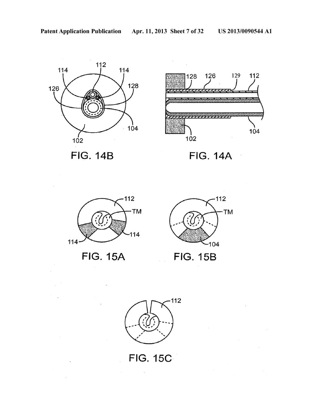 SYSTEM AND METHOD FOR THE SIMULTANEOUS BILATERAL TREATMENT OF TARGET     TISSUES WITHIN THE EARS USING A GUIDE BLOCK STRUCTURE - diagram, schematic, and image 08