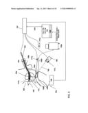 FOCUSED PROSTATE CANCER TREATMENT SYSTEM AND METHOD diagram and image