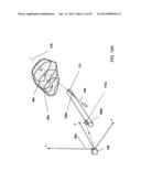 FOCUSED PROSTATE CANCER TREATMENT SYSTEM AND METHOD diagram and image