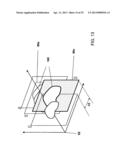 FOCUSED PROSTATE CANCER TREATMENT SYSTEM AND METHOD diagram and image