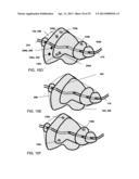 FOCUSED PROSTATE CANCER TREATMENT SYSTEM AND METHOD diagram and image