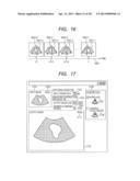 ULTRASOUND IMAGE RECONSTRUCTION METHOD, DEVICE THEREFOR, AND ULTRASOUND     DIAGNOSTIC DEVICE diagram and image