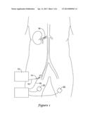 INTRAVASCULAR TEMPERATURE MONITORING SYSTEM diagram and image