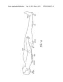 METHODS AND SYSTEMS FOR MONITORING AND PREVENTING PRESSURE ULCERS diagram and image