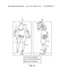 METHODS AND SYSTEMS FOR MONITORING AND PREVENTING PRESSURE ULCERS diagram and image