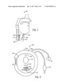 DETECTION AND TREATMENT OF ABNORMAL ESOPHAGEAL SPHINCTER FUNCTIONALITY diagram and image