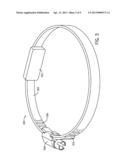 DETECTION AND TREATMENT OF ABNORMAL ESOPHAGEAL SPHINCTER FUNCTIONALITY diagram and image