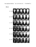 Pulsed Cavitational Therapeutic Ultrasound With Dithering diagram and image