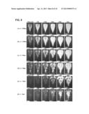 Pulsed Cavitational Therapeutic Ultrasound With Dithering diagram and image