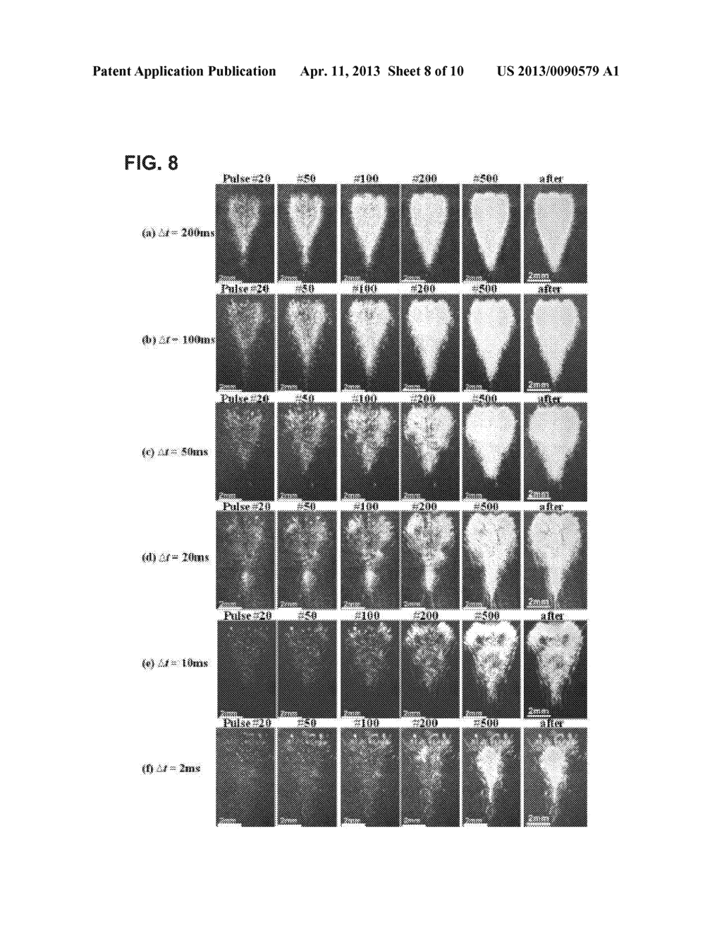 Pulsed Cavitational Therapeutic Ultrasound With Dithering - diagram, schematic, and image 09