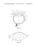 Ocular Insert Apparatus and Methods diagram and image