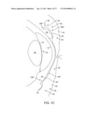 Ocular Insert Apparatus and Methods diagram and image