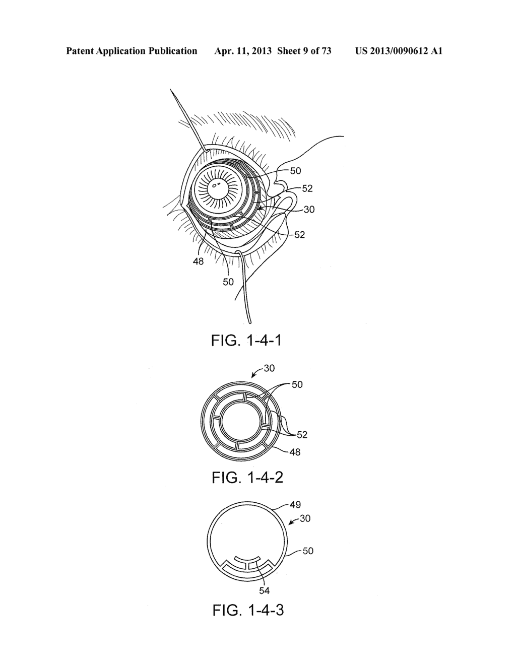 Ocular Insert Apparatus and Methods - diagram, schematic, and image 10