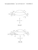 Ocular Insert Apparatus and Methods diagram and image