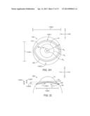 Ocular Insert Apparatus and Methods diagram and image