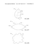 Ocular Insert Apparatus and Methods diagram and image