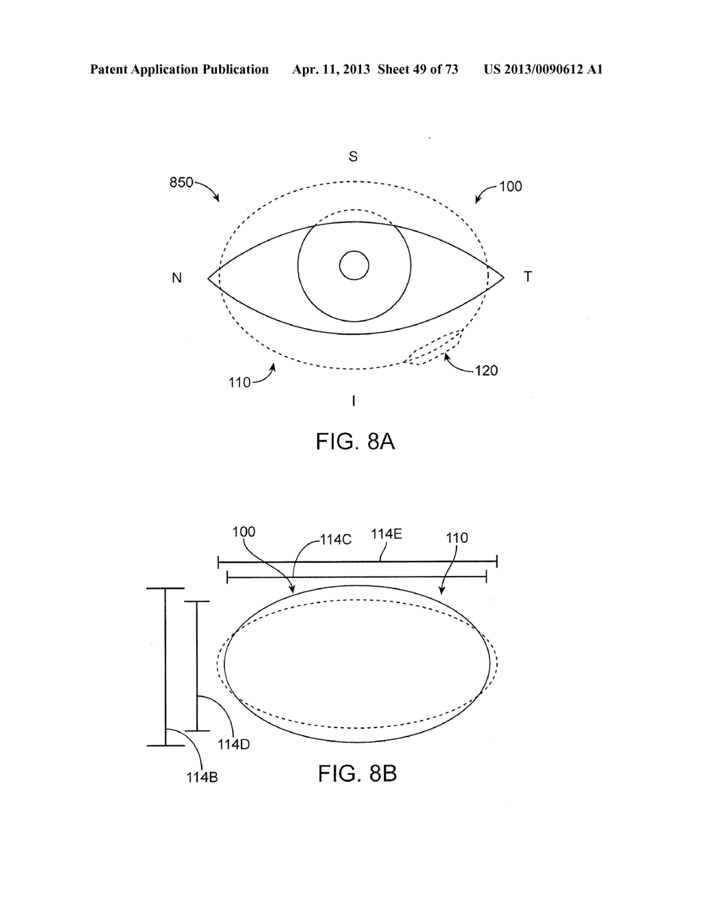 Ocular Insert Apparatus and Methods - diagram, schematic, and image 50