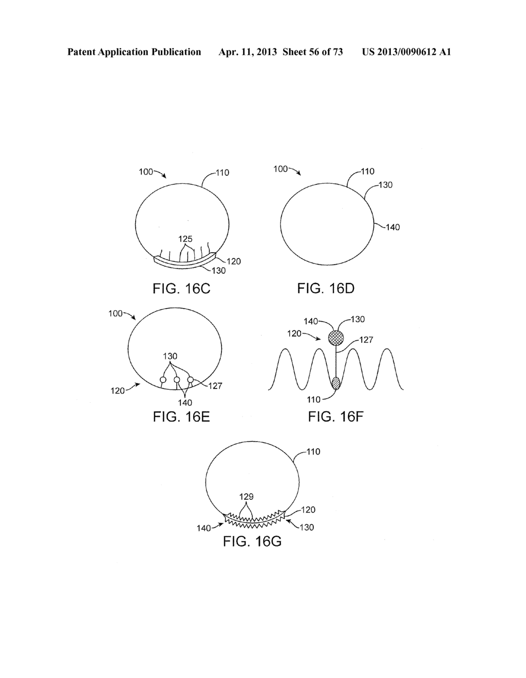 Ocular Insert Apparatus and Methods - diagram, schematic, and image 57
