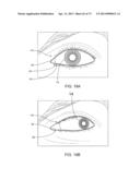 Ocular Insert Apparatus and Methods diagram and image