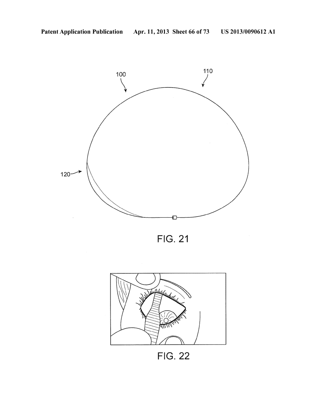 Ocular Insert Apparatus and Methods - diagram, schematic, and image 67