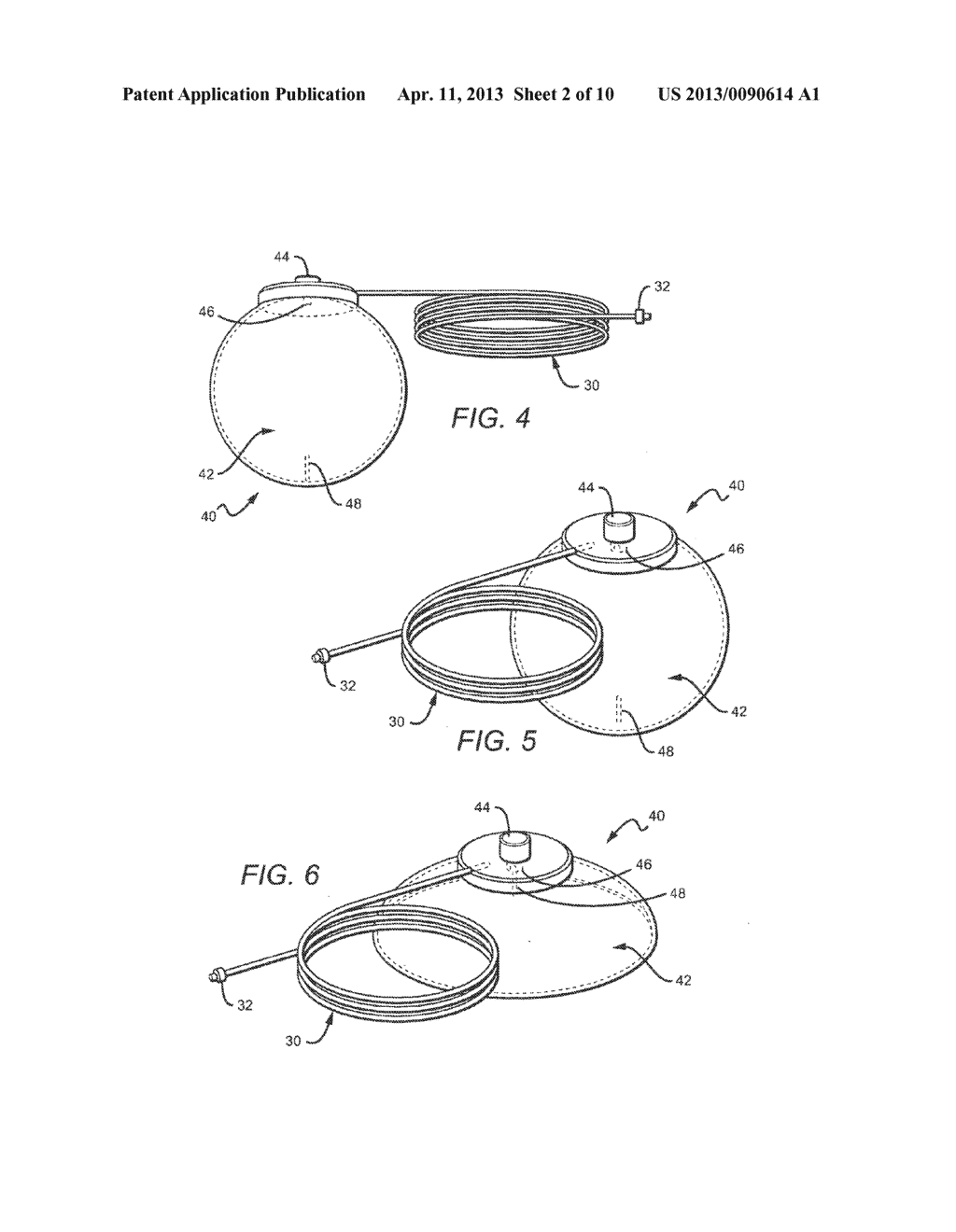 Corporeal Drainage System - diagram, schematic, and image 03