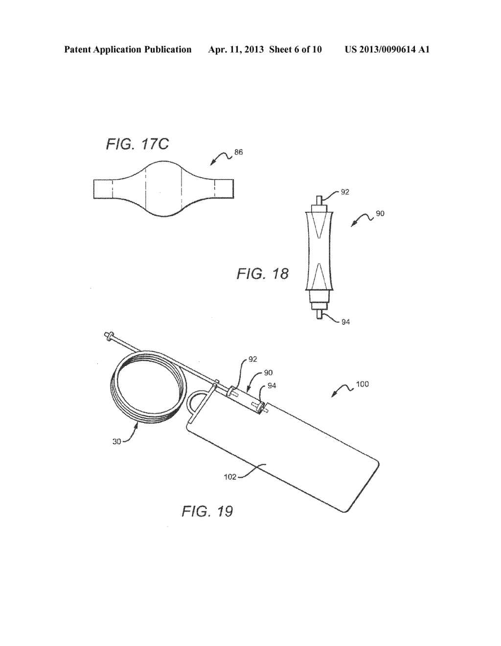 Corporeal Drainage System - diagram, schematic, and image 07