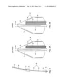 VASCULAR DELIVERY METHODS diagram and image