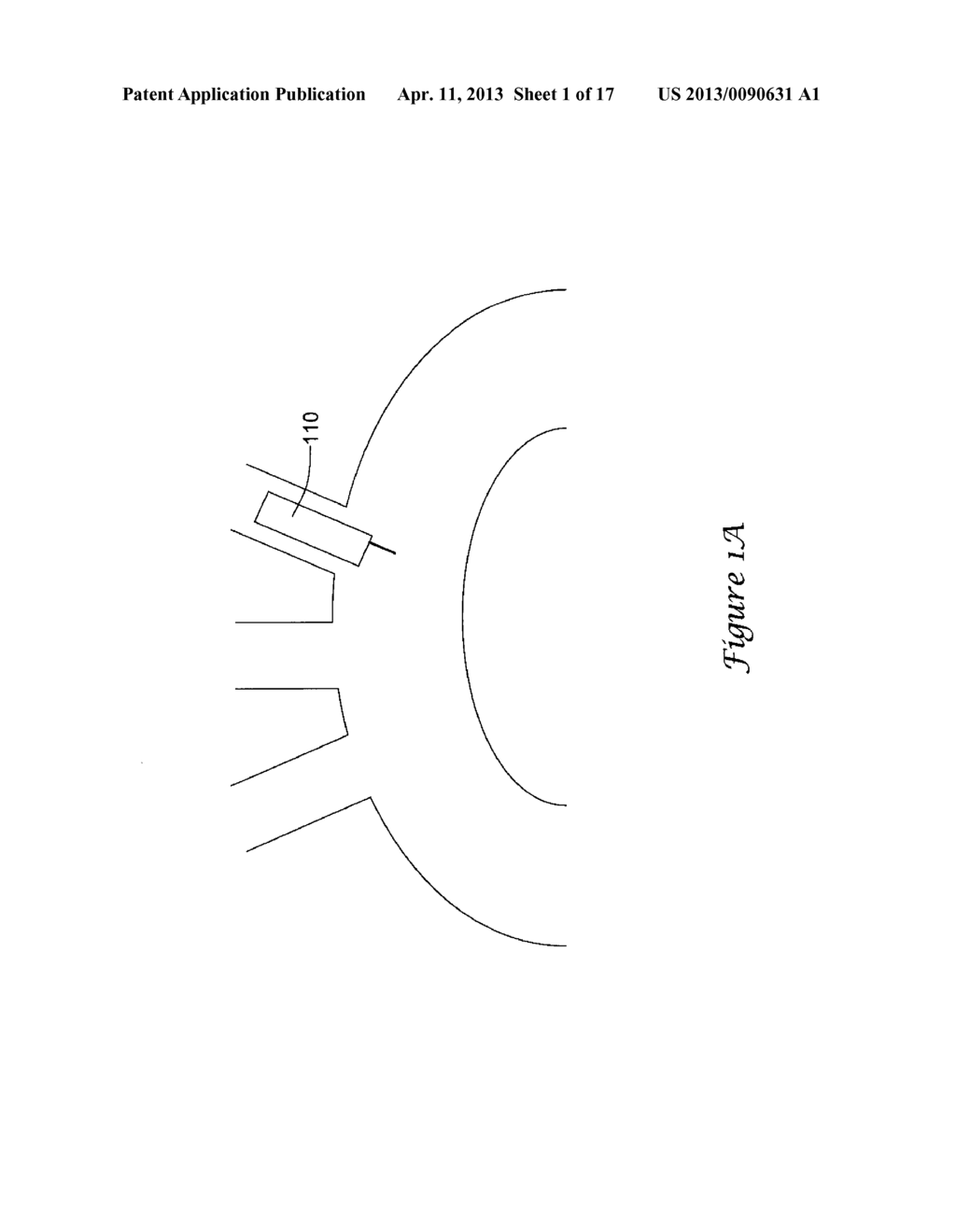 MEDICAL DEVICE DELIVERY APPARATUS - diagram, schematic, and image 02