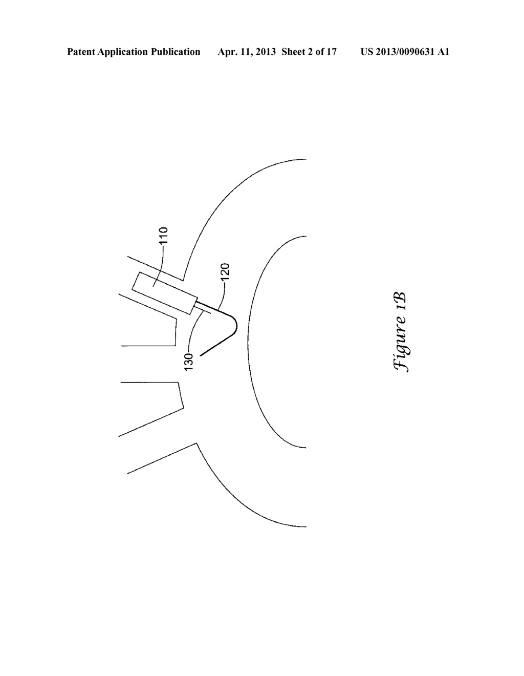 MEDICAL DEVICE DELIVERY APPARATUS - diagram, schematic, and image 03