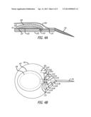 OSMOTIC PATCH PUMP diagram and image