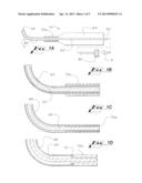 Probes for Use in Ophthalmic and Vitreoretinal Surgery diagram and image