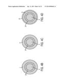 Multiple Treatment Zone Ablation Probe diagram and image