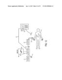 Multiple Treatment Zone Ablation Probe diagram and image