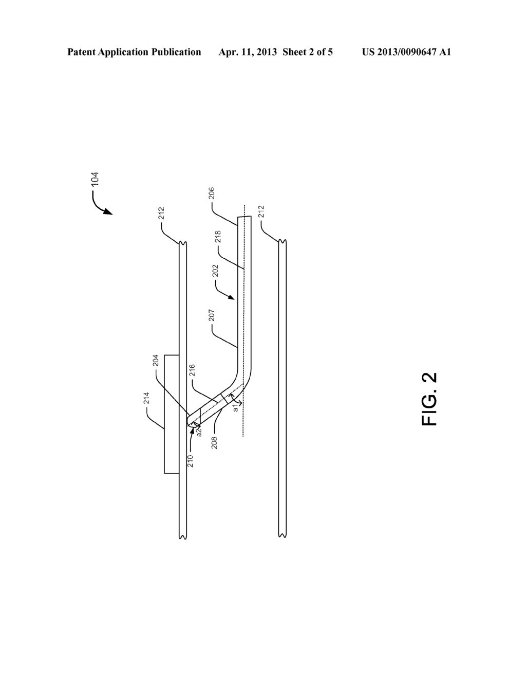 ABLATION CATHETER WITH INSULATED TIP - diagram, schematic, and image 03