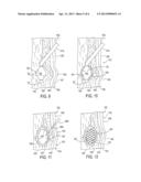 Method for Ablating Tissue to Facilitate Implantation and Apparatus and     Kit for Use Therewith diagram and image