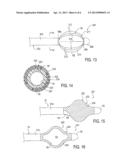 Method for Ablating Tissue to Facilitate Implantation and Apparatus and     Kit for Use Therewith diagram and image