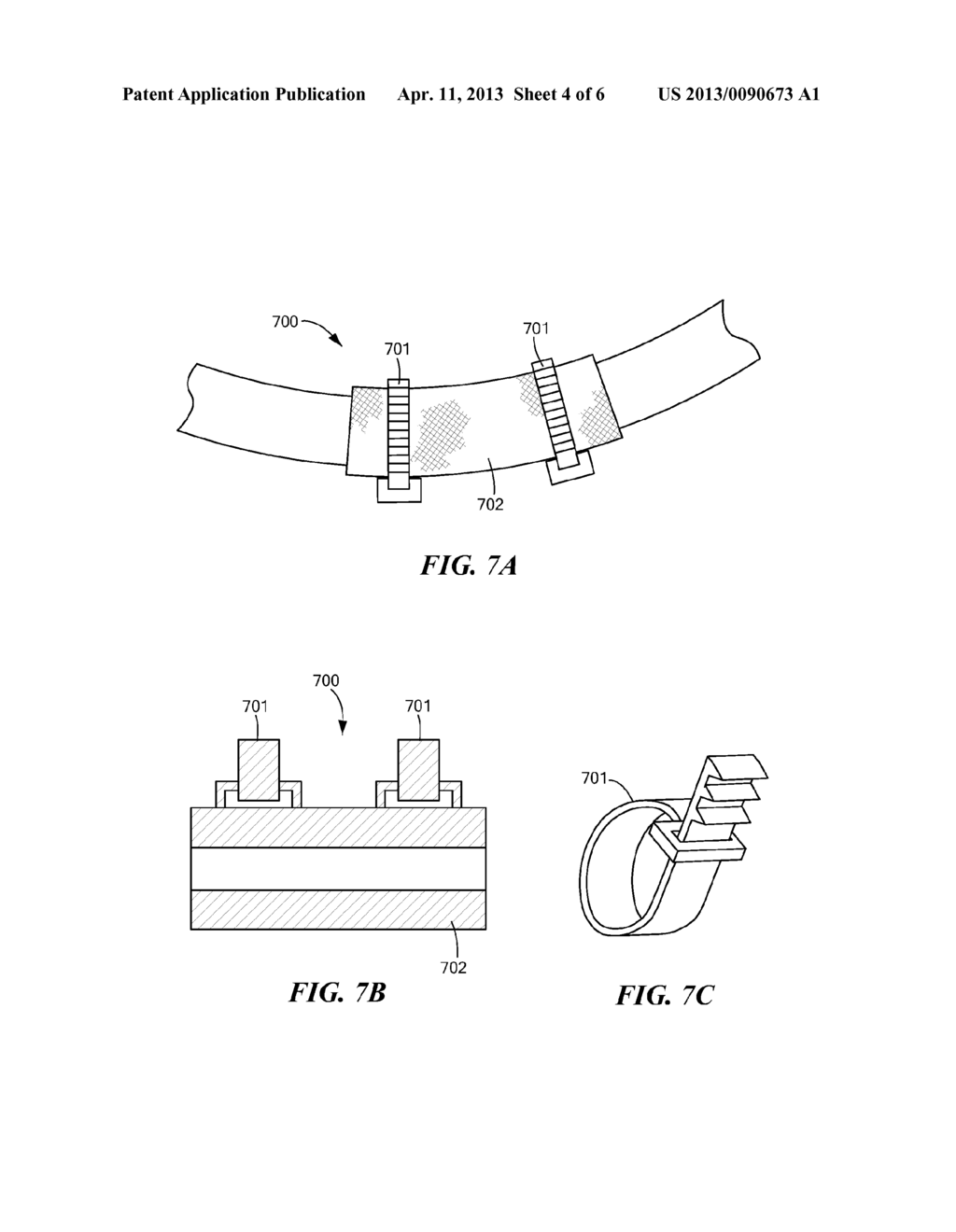 Vascular Clamps for Vascular Repair - diagram, schematic, and image 05