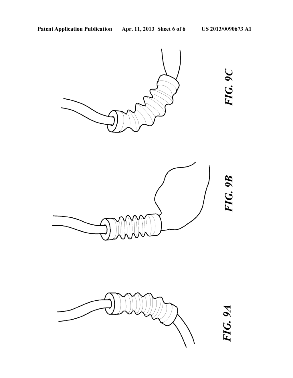 Vascular Clamps for Vascular Repair - diagram, schematic, and image 07