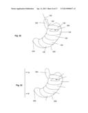 SYSTEMS AND METHODS FOR VOLUME REDUCTION diagram and image