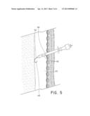 DILATING DEVICE diagram and image