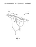 DEVICES, SYSTEMS AND METHODS FOR ENCLOSING AN ANATOMICAL OPENING diagram and image