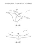 DEVICES, SYSTEMS AND METHODS FOR ENCLOSING AN ANATOMICAL OPENING diagram and image